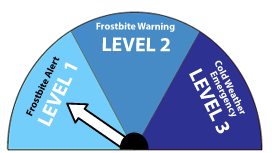 frostbite alert labe