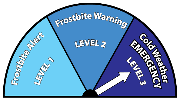 frostbite emergency label