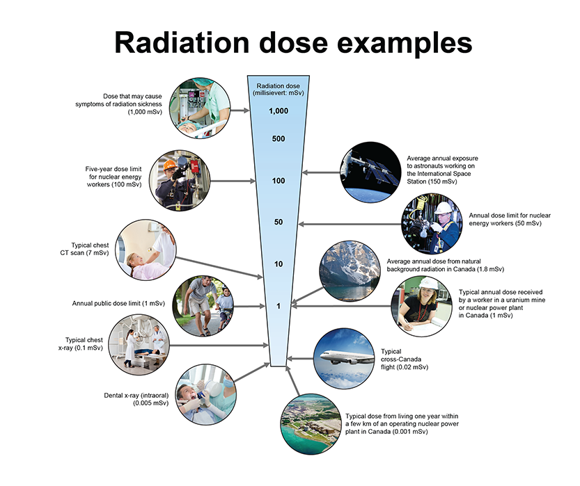 radiation doses examples